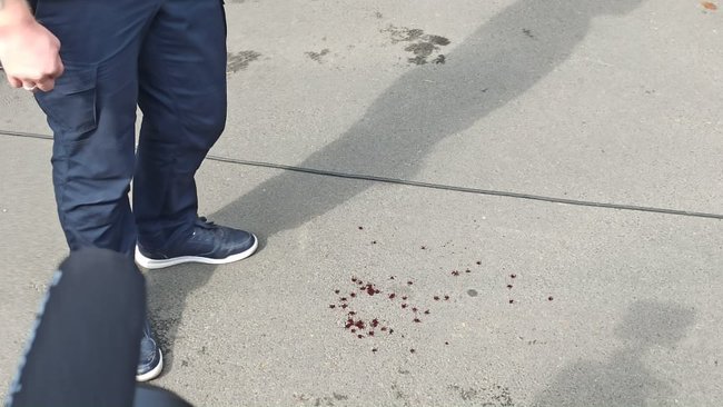 Член Нацкорпуса Кухарчук, которому вручили подозрение за акцию под ОП, порезал себе вены в знак протеста против преследования ветеранов 06 Член Нацкорпуса Кухарчук, которому вручили подозрение за акцию под ОП, порезал себе вены в знак протеста против преследования ветеранов 06