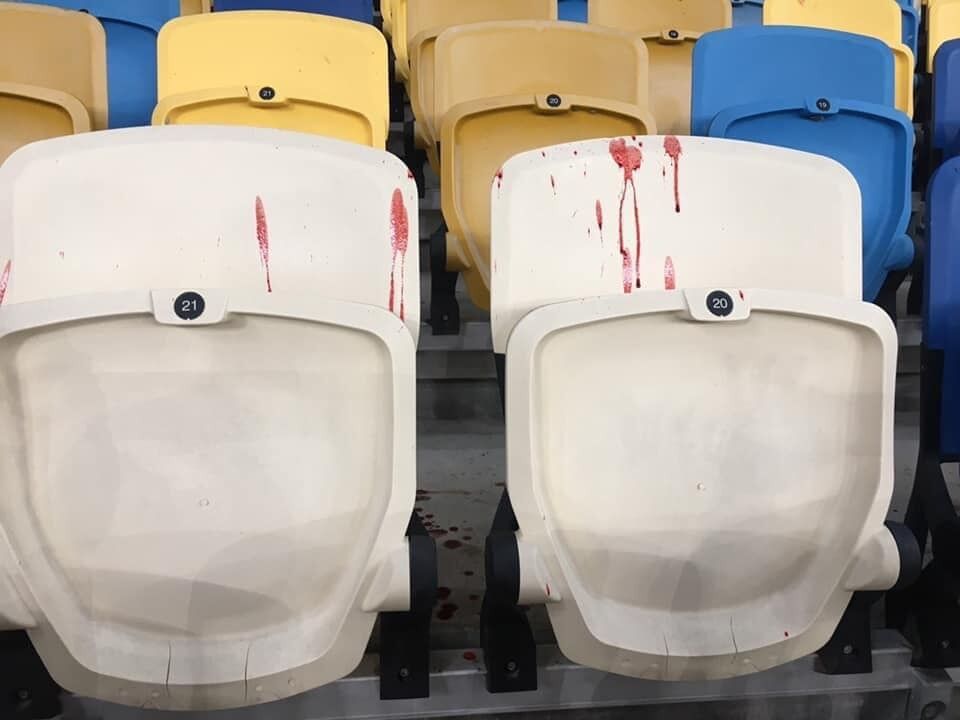 Последствия нападения