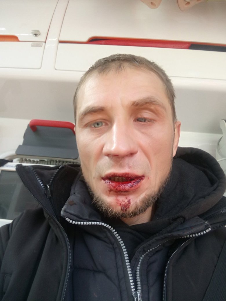         -  01 dqxikeidqxidqeant