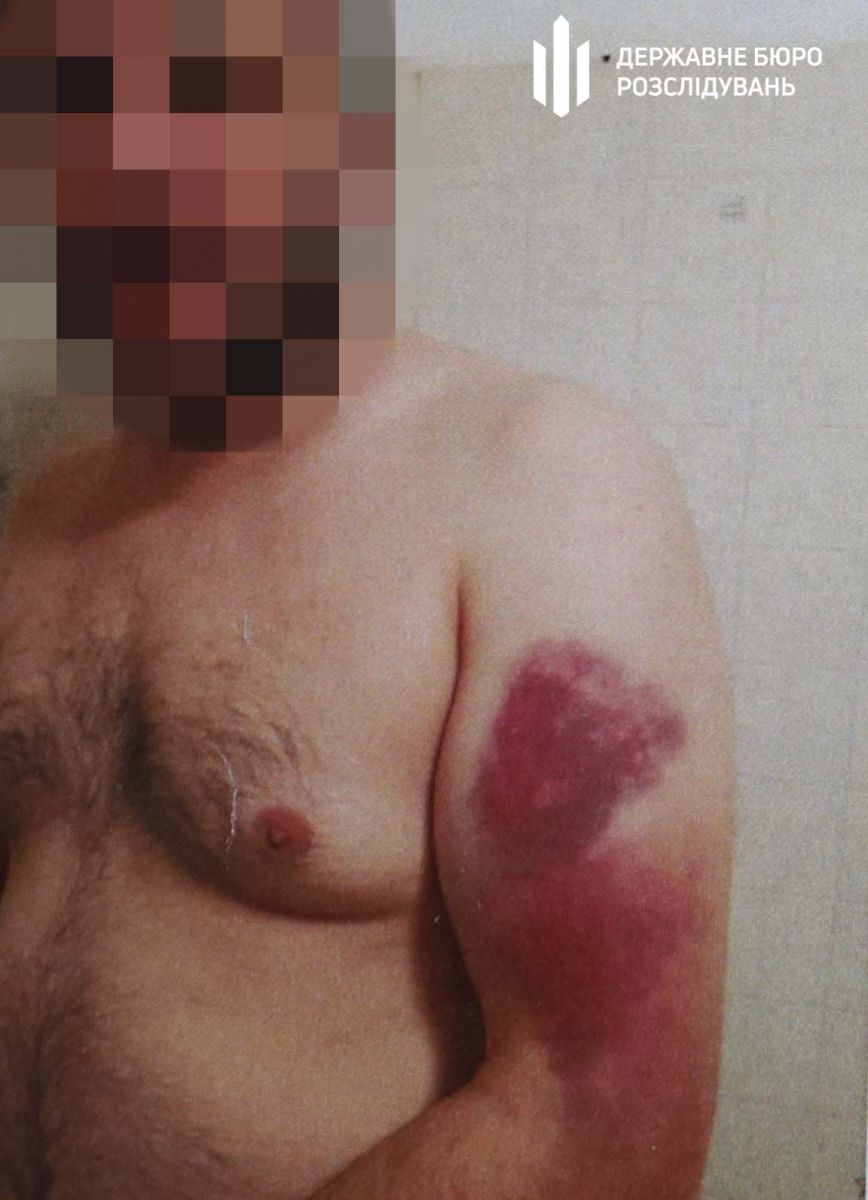 пострадавший dqxikeidqxidqrant