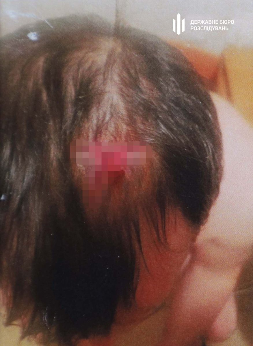 пострадавший