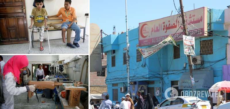 Ампутации проводили в том числе детям