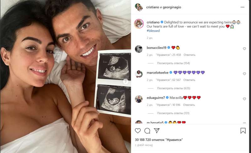 На снимках УЗИ видно двойню dqxikeidqxidqrant