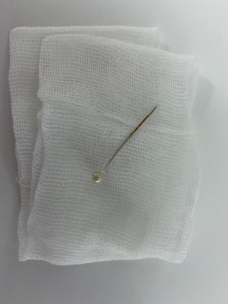 Детские врачи, иголка у ребенка, достать иголку, иголка в горле, детская операция dqxikeidqxidqrant