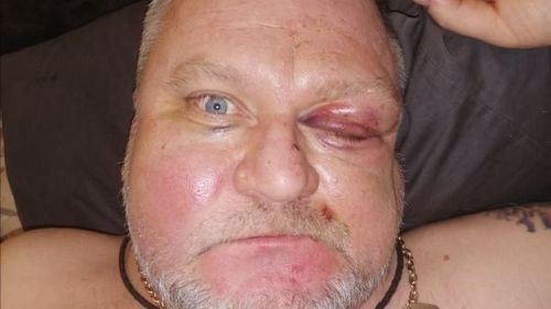 41515 dqxikeidqxidqrant