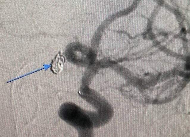 У Дніпрі нейрохірурги провели операцію вагітній  dqxikeidqxiqzhant