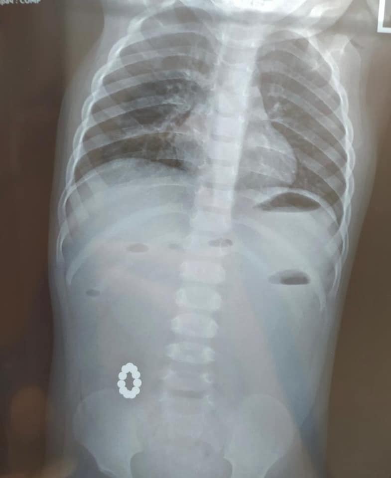   -       () dqxikeidqxiuuant