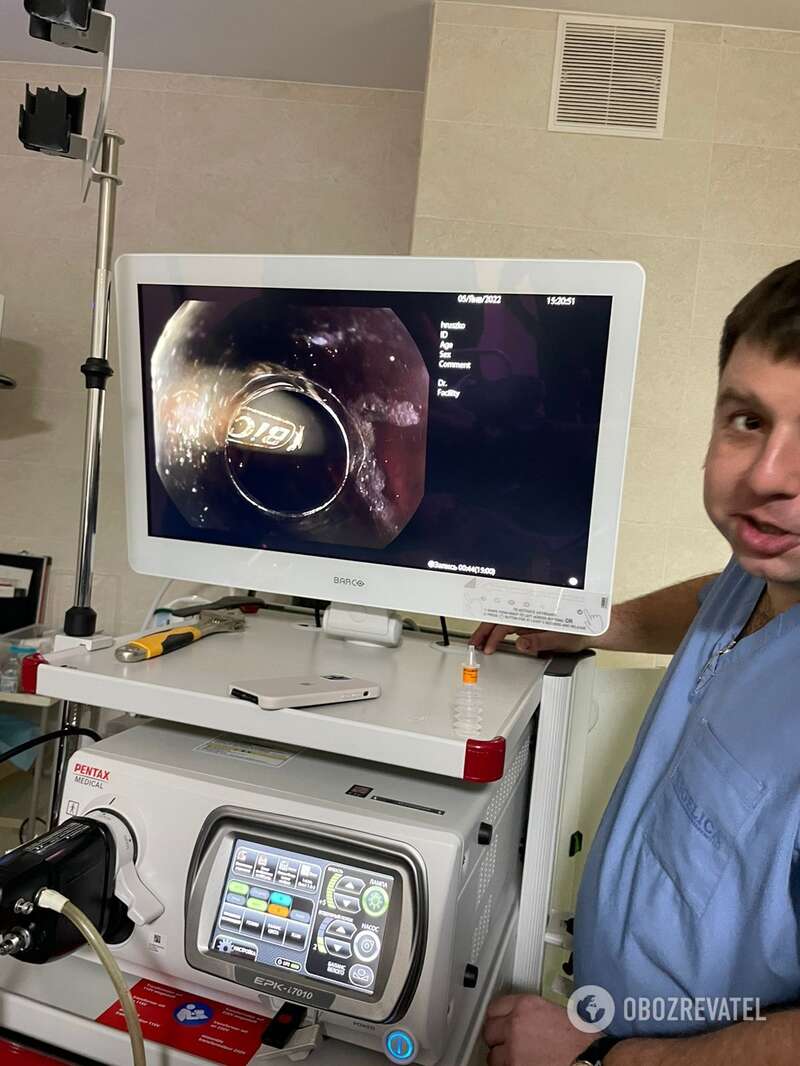 В больницу пациент обратился только на четвертые сутки dqxikeidqxidqeant