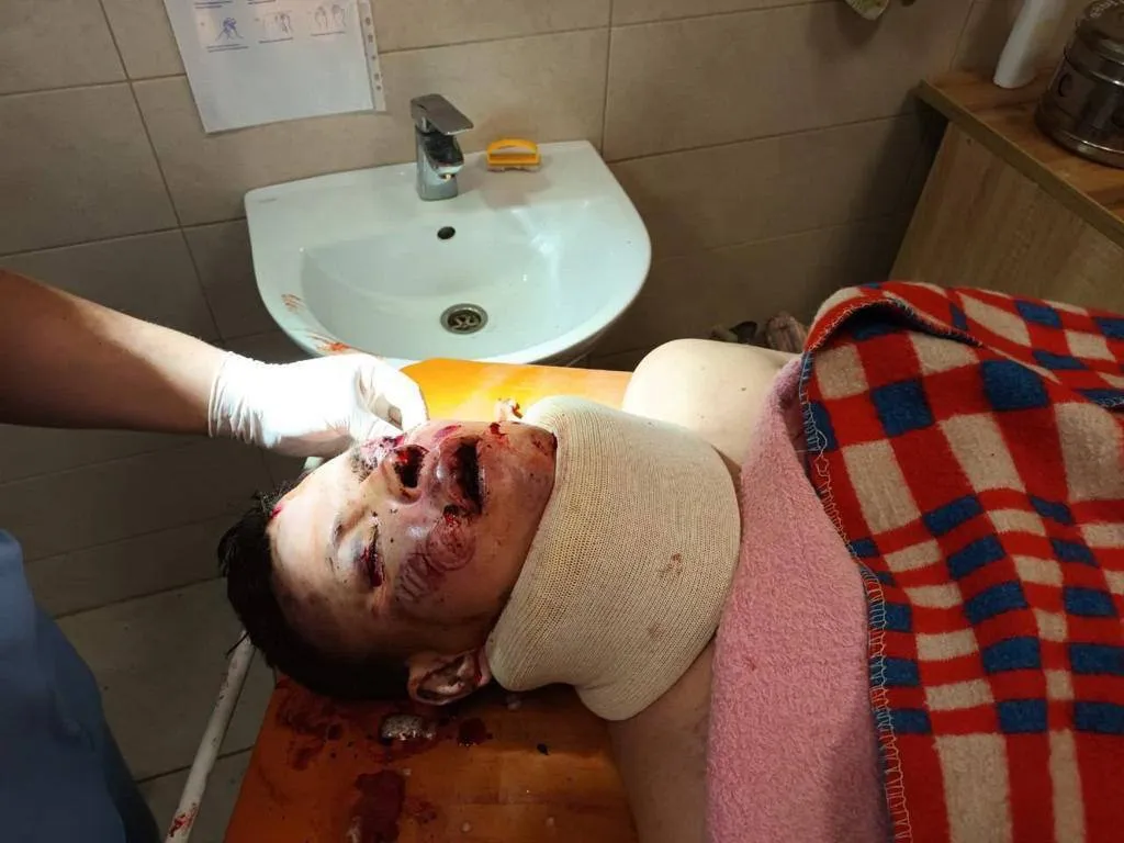 Военнопленному оказали медпомощь