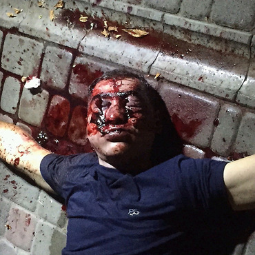 В центре Одессы неизвестный ударил кастетом мужчину и прыгал на его голове пока тот не скончался, милиция не комментирует - Copyright https://news.pn dqxikeidqxidqeant