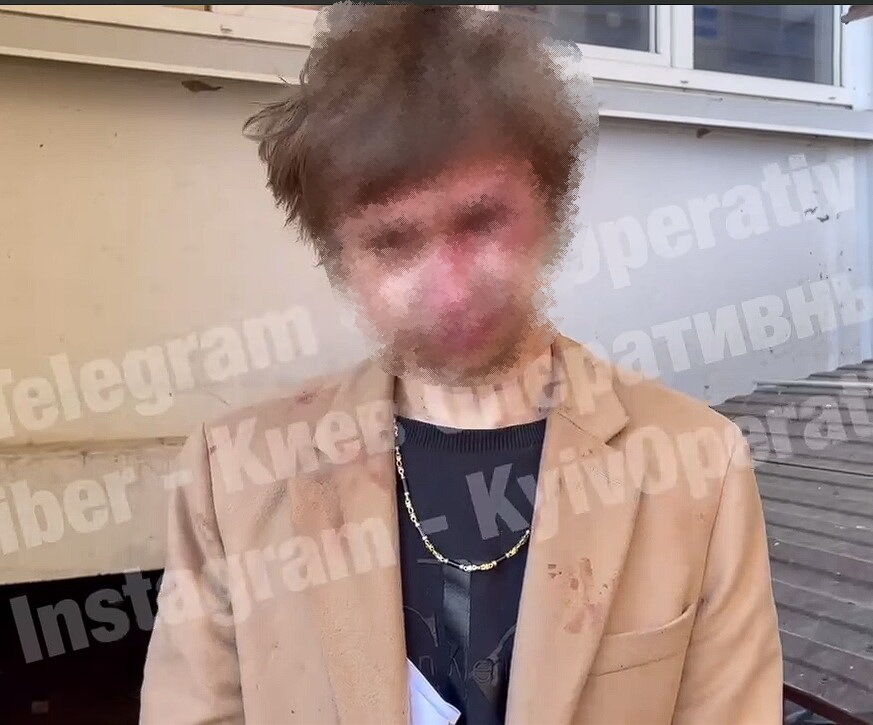 Якобы злоумышленник был в состоянии наркотического опьянения. dqxikeidqxiqetant