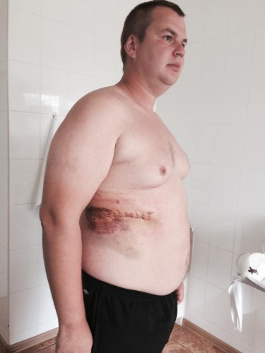 Раненый Булатов в больнице