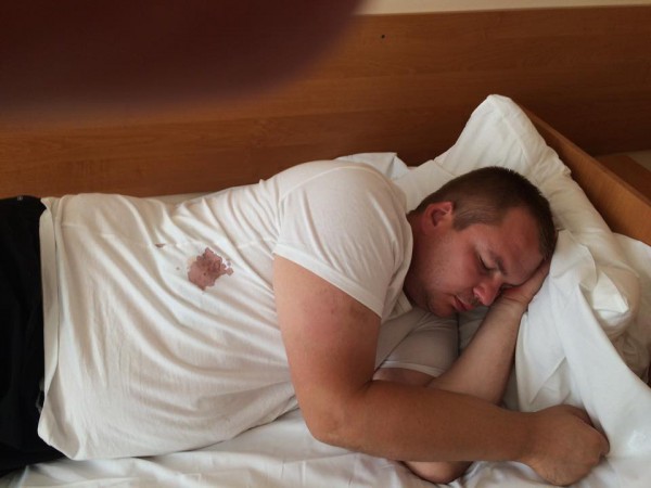 Раненый Булатов в больнице