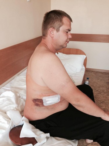 Раненый Булатов в больнице