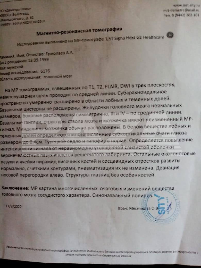 в РФ мобилизировали пенсионера с ишемией