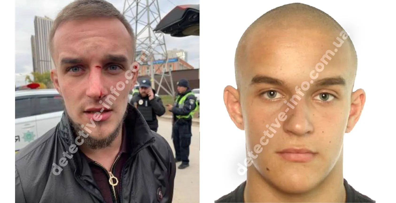 Вбивцею військового у Києві виявився український чемпіон – ЗМІ dqxikeidqxidqeant