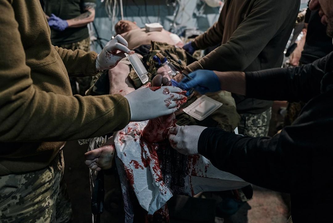 "Хвилина зволікання може коштувати життя": опубліковано важкі фото із стабпункту під Бахмутом