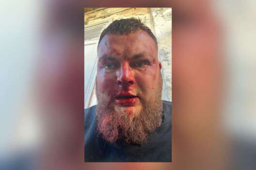 Одеський активіст Ганул звинуватив Труханова в нападі-1200x800 dqxikeidqxiqdzant