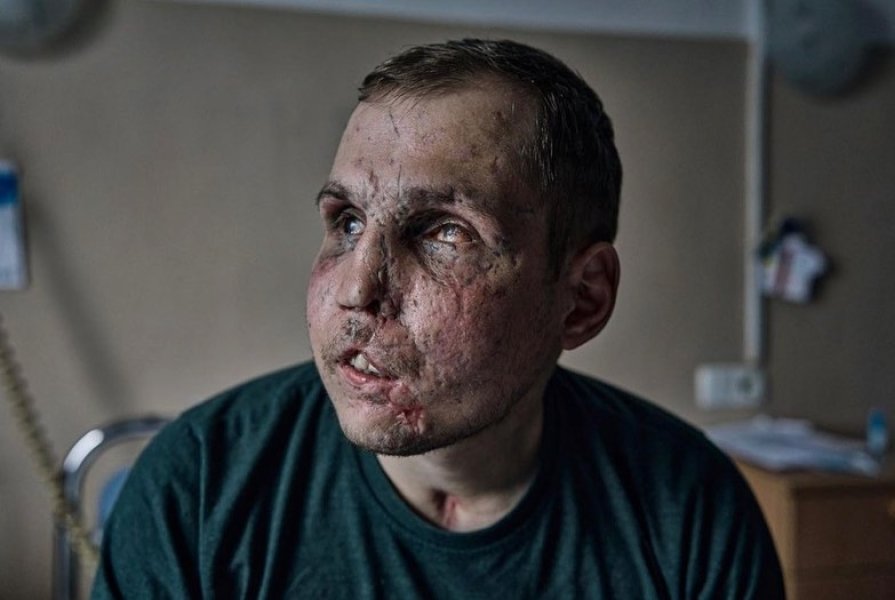 26-річний український військовослужбовець Сергій Райлян