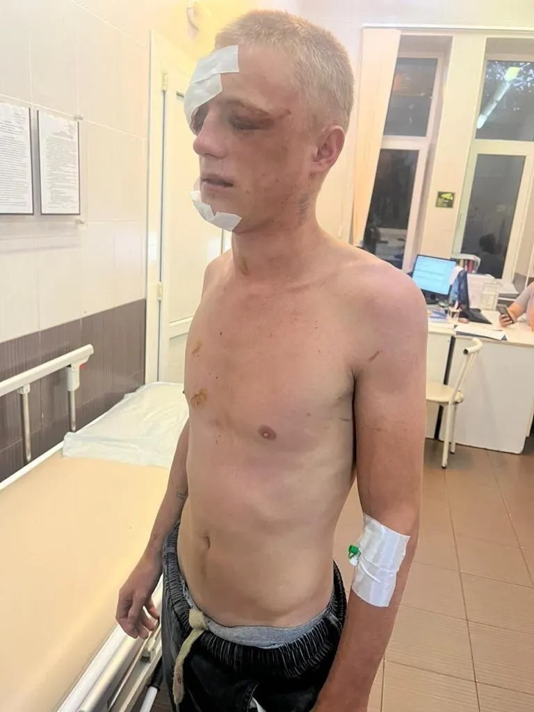 У Росії на смерть забили камінням двох