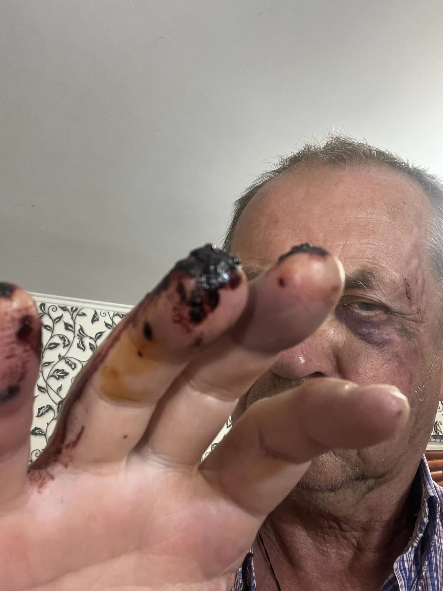 Volodimyr Sedov Ukraine dqxikeidqxidqrant