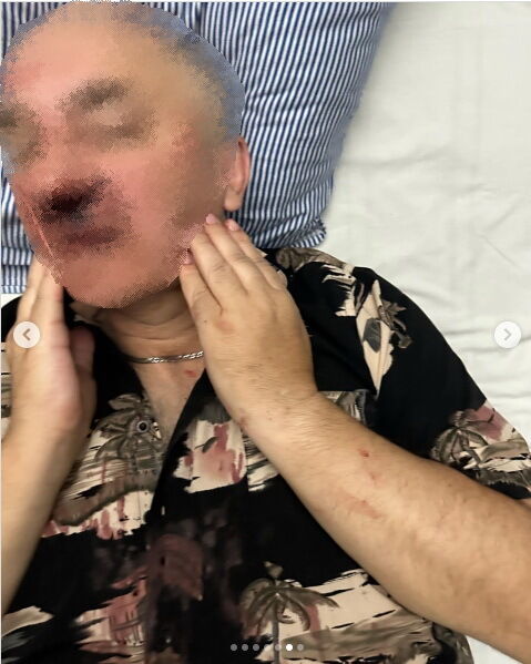 У Києві двоє неповнолітніх через зауваження побили пенсіонера-охоронця школи. Фото