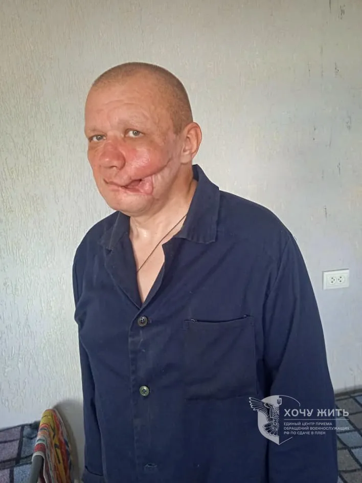 Росія не забирає своїх поранених полонених: проєкт