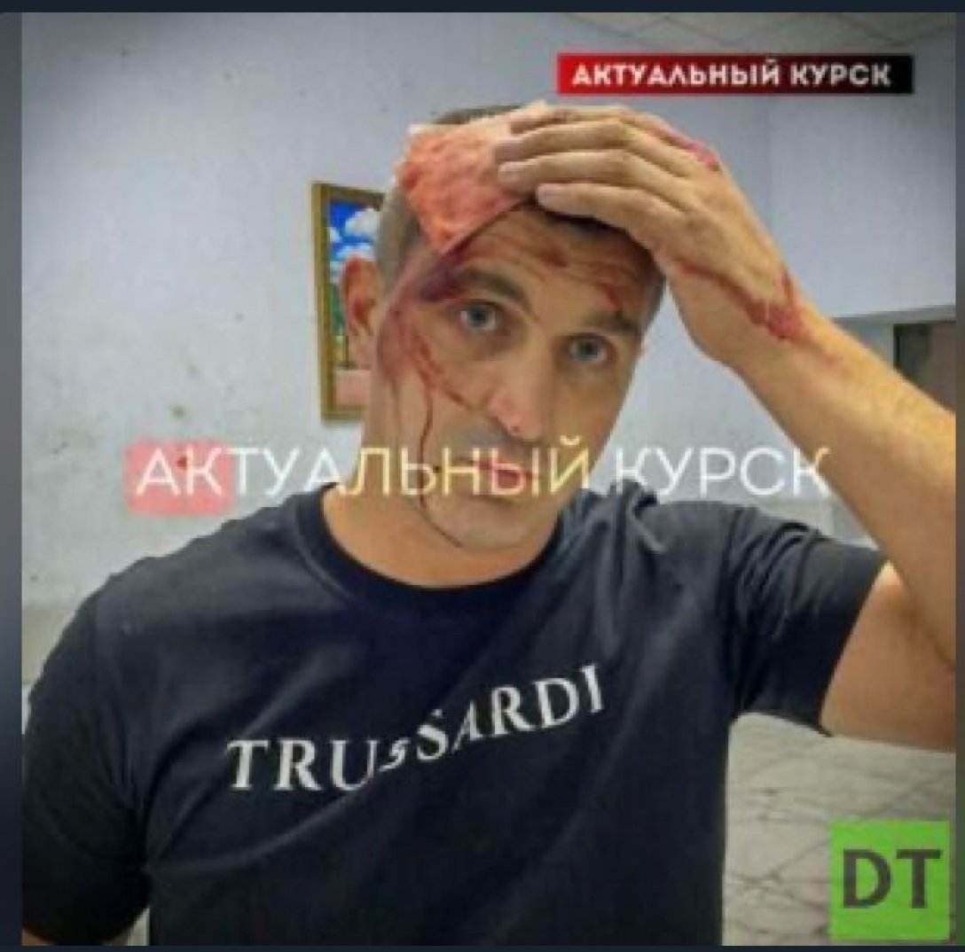 Російський депутат Микола Ішаков, Маріуполь, побиття dqxikeidqxidqrant