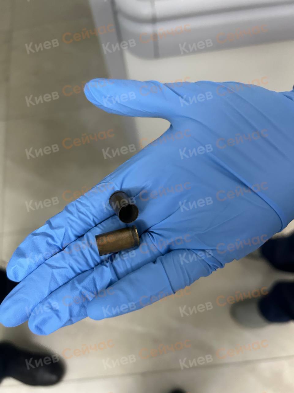 У Києві на Осокорках чоловіку під час прогулянки прострелили ноги. Фото