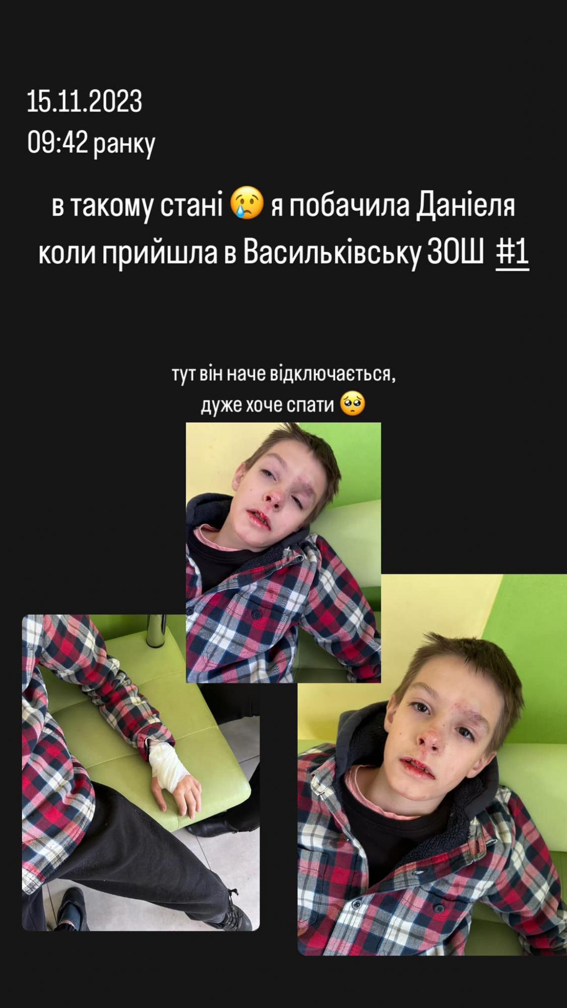 В школі під Києвом дитину скинули з висоти, а директор