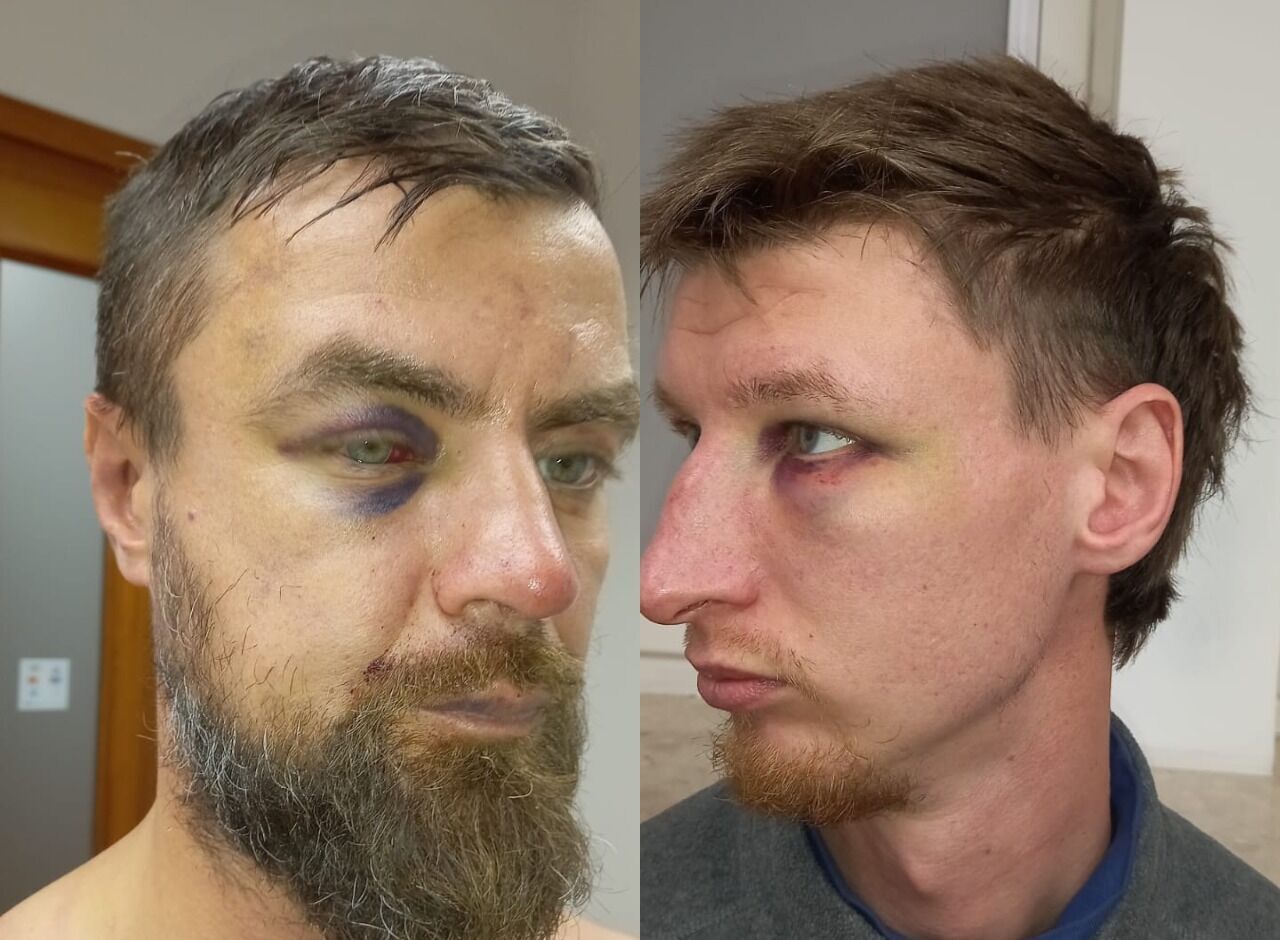 У Варшаві поліція побила двох українців через словесний конфлікт з поляками, – правозахисник dqxikeidqxidqeant