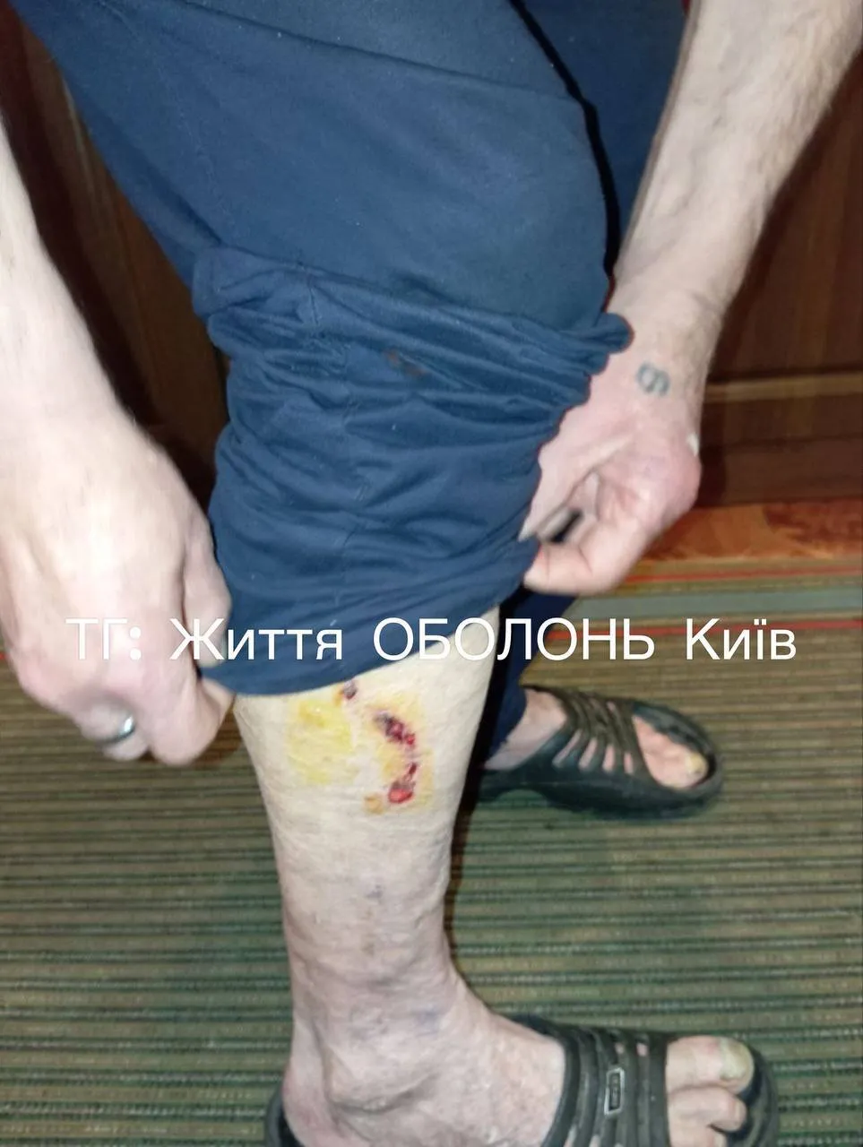         :   dqxikeidqxidqrant