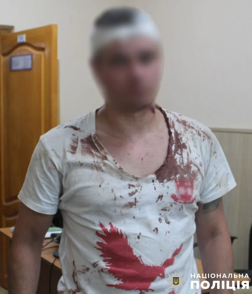 У Києві конфлікт між двома друзями ледь не закінчився жорстоким вбивством. Подробиці справи