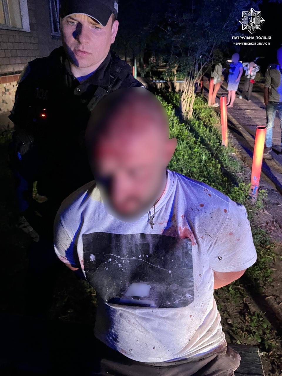 В Чернигове мужчина бросался на людей с ножом: ранен (фото) dqxikeidqxidqeant