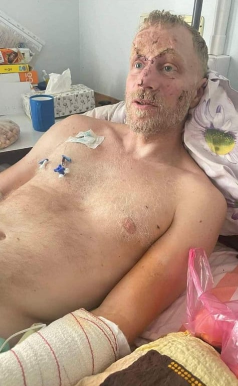 Андрій Валенський був поранений на війні dqxikeidqxidqrant