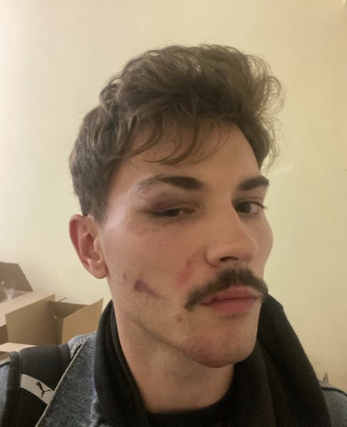 Владислав Каплієнко, побили ТЦК, мобілізація в Україні dqxikeidqxidqrant