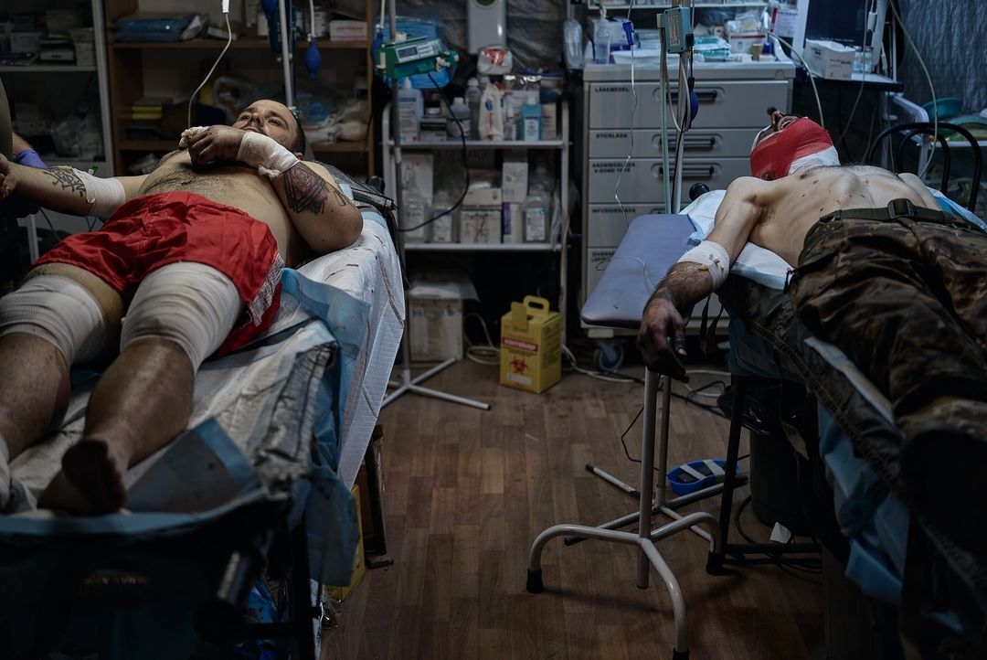 Пулевое ранение в голову, нет части челюсти: как медики спасают жизнь воинов на Кураховском направлении. Фото