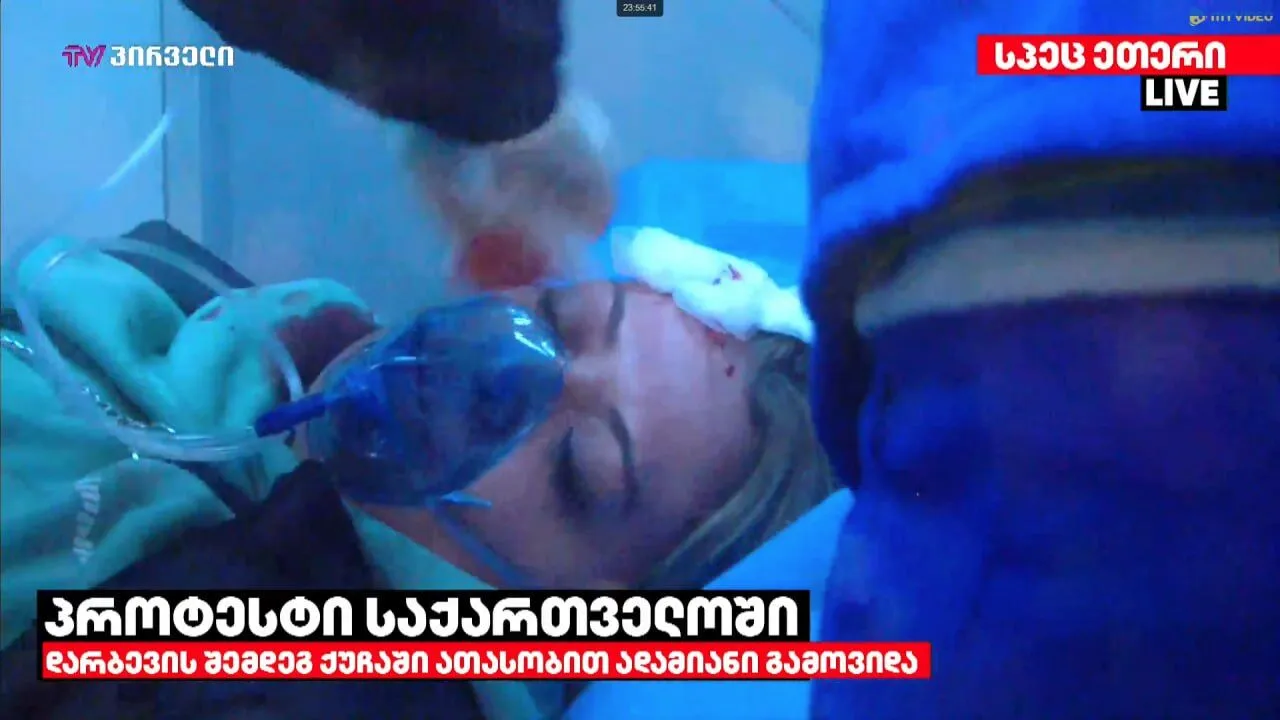 В Тбилиси ситуация обостряется: полиция применяет водометы и слезоточивый газ против активистов, есть пострадавшие. Фото и видео