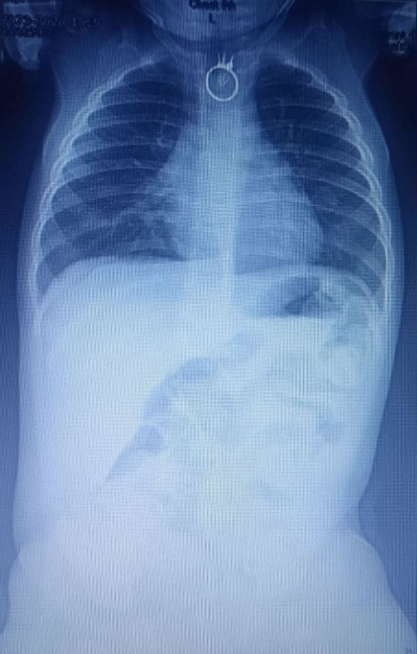 ©   dqxikeidqxidqrant