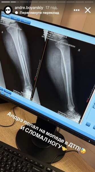 Андре Боярский попал в ДТП Андре Боярский, Боярский, Боярский блогер, ДТП, авария, Боярский ДТП, Боярский ДТП, Боярский авария