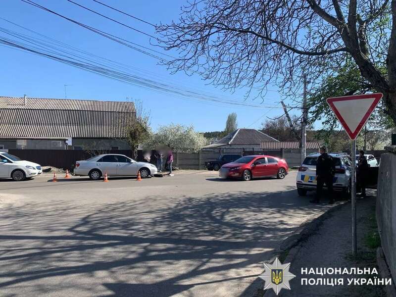 Під Києвом легковик збив дитину, яка їхала на електросамокаті. Подробиці ДТП та фото dqxikeidqxidqrant