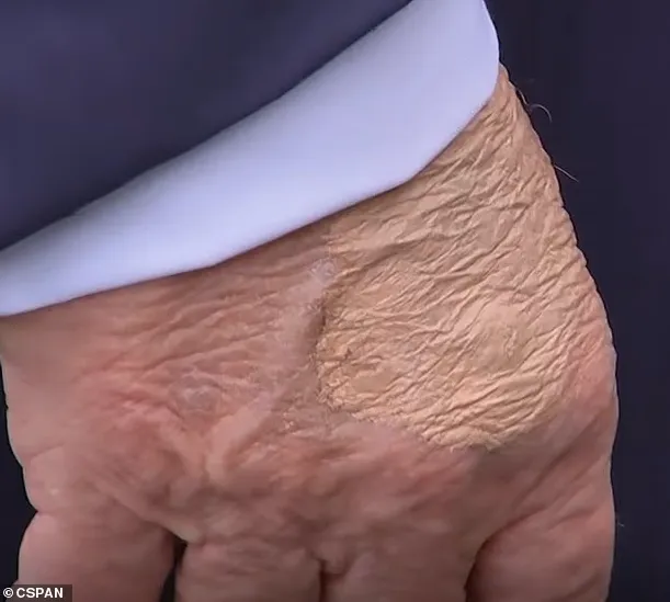 На руке Трампа заметили подозрительный dqxikeidqxidqeant