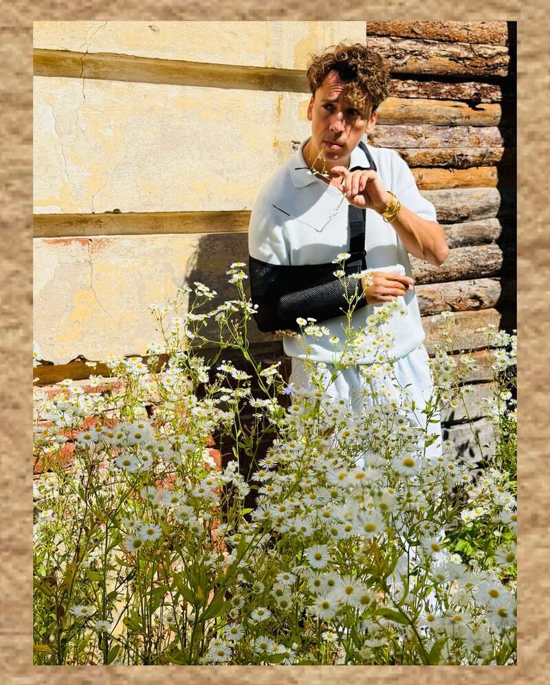 Галкін через тиждень після ДТП показав нові фото з загіпсованою рукою і приголомшив мережу