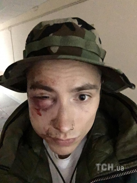 побитий учасник Quest Pistols Show_2